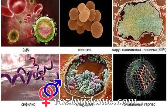 болезни передающиеся половым путем