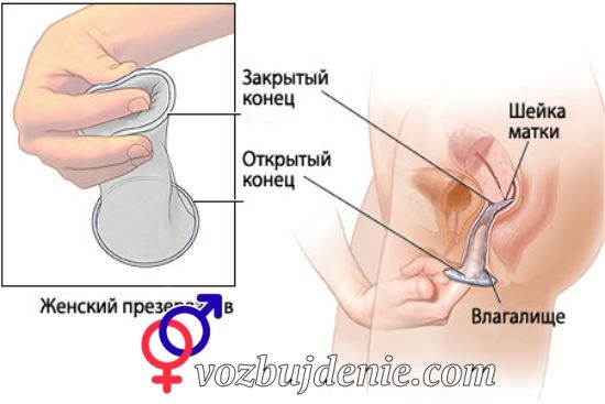 как правильно устанавливать женский презерватив